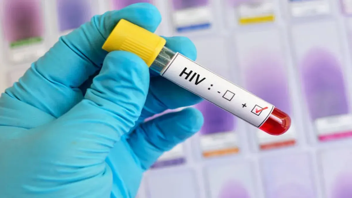 પાકિસ્તાનમાં HIVનો ભયાનક પ્રકોપ; કરાચીની હોસ્પિટલમાં 6 બાળકોના મોત, 94 લોકો સંક્રમિત